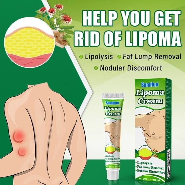 Crema de lipomas Sumifun limpieza antibacteriana celulitis eliminación de bultos de grasa